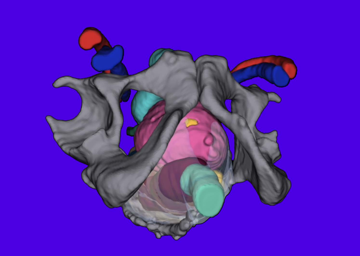 Intermountain Health First to Use New 3D Technology for Patients Undergoing Complex Cancer Surgery