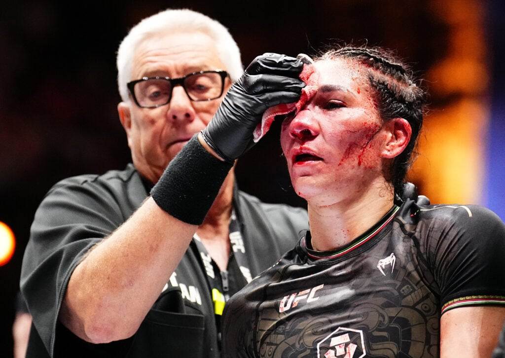 UFC doctor shares horror pictures of the ‘worst cut in history’ suffered by Irene Aldana at Noche UFC last night